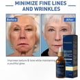 thumbnail image 5 of Anti-Wrinkle Face & Neck Serum, Delicate Skin Essence for Fine Lines, Suitable for All Skin Types, Lightweight Formula for Daily Use, 5 of 5