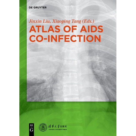 Atlas of AIDS Co-Infection, (Hardcover)