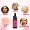 thumbnail image 4 of Essential oils Essential Oil Rose Oil Organic,Rose Oil For Diffuser, Sleep, Massage, Skin Care, Aromatherapy, Bath10ml(buy 2 get 10% off), 4 of 5