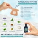 thumbnail image 5 of Kit de tratamiento de hongos en las uñas OSIMOON Extra Strength con solución, 5 of 7
