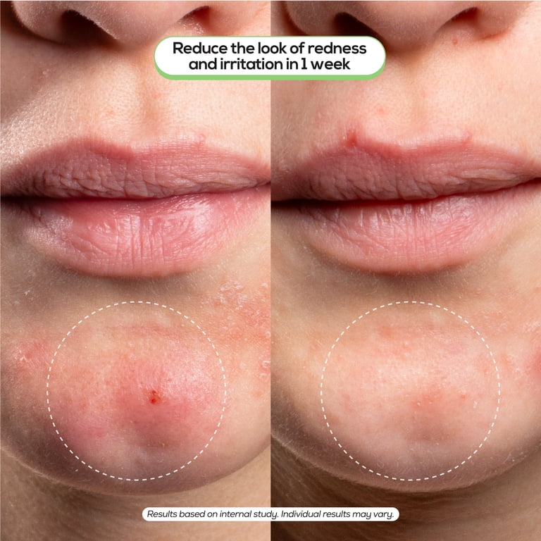 Hanhoo Barrier Support Moisturizer With Ceramides & Hyaluronic Acid photo 6