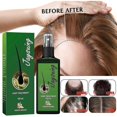 thumbnail image 2 of Jaysuing Hair Growth Spray Effective Nourishing Root Hair Thick Growth Liquid Anti-fall Scalp Massage Repair Spray Xinda |, 2 of 4