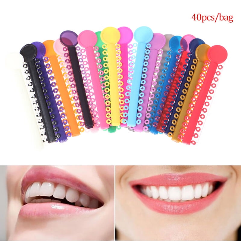 DentalSmile Orthodontic Ligature Ties Orthodontic Elastomeric O-rings Braces Rubber - View #2