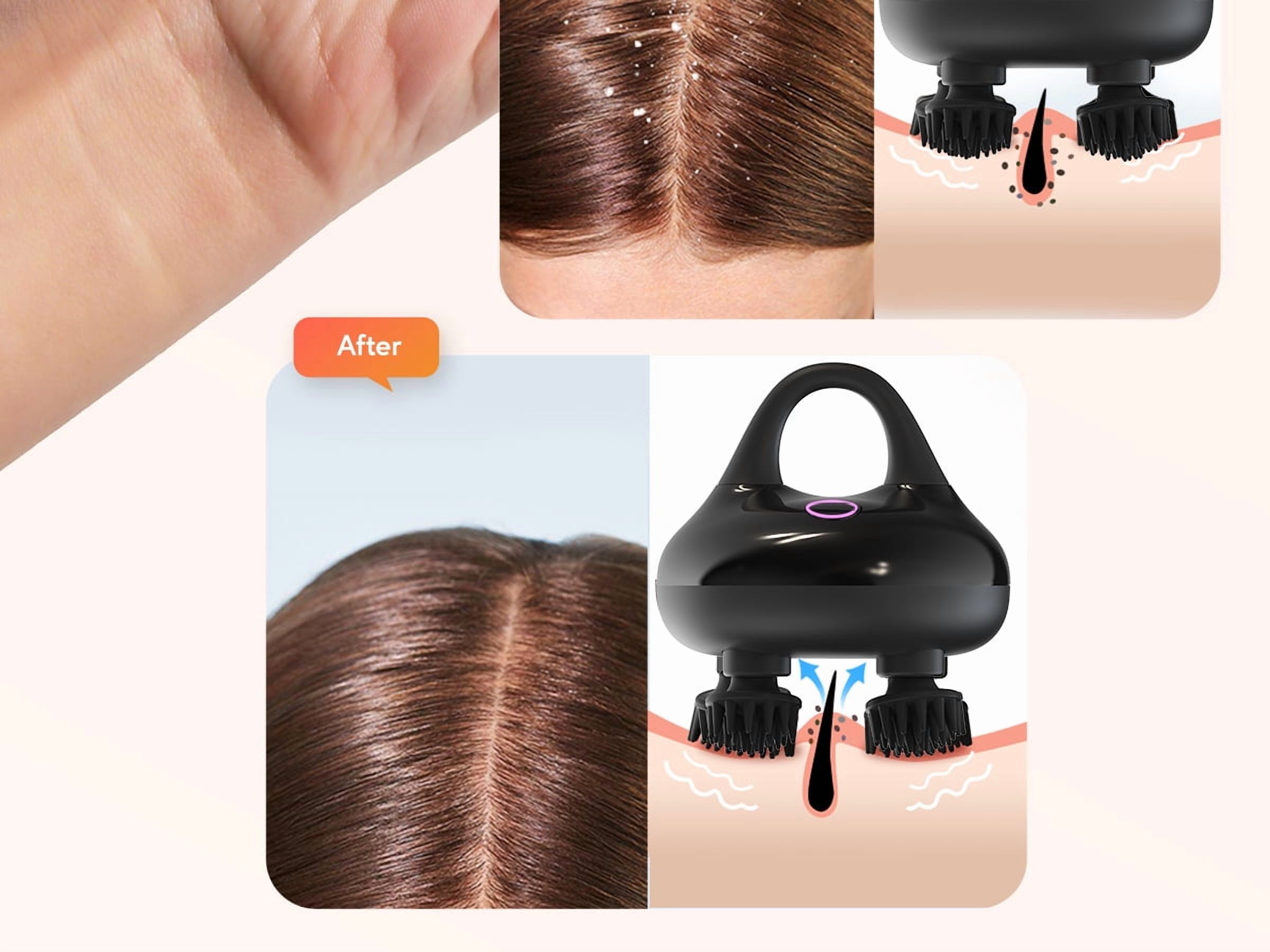 Arboleaf Electric Scalp Massager Handheld - Waterproof IPX7, 8 Removable Claws - Black