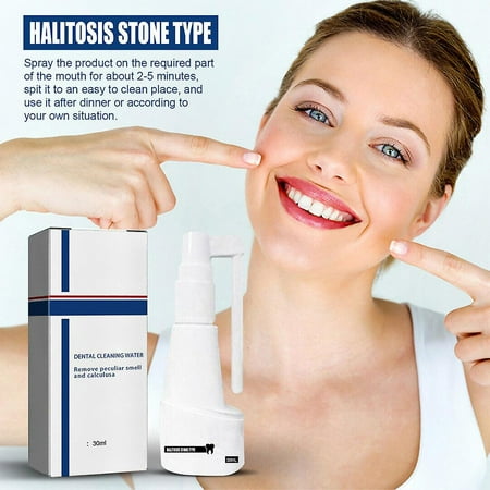 Tartar-free Dissolving Spray Tartar Removal Teeth Cleaner Powerful ...