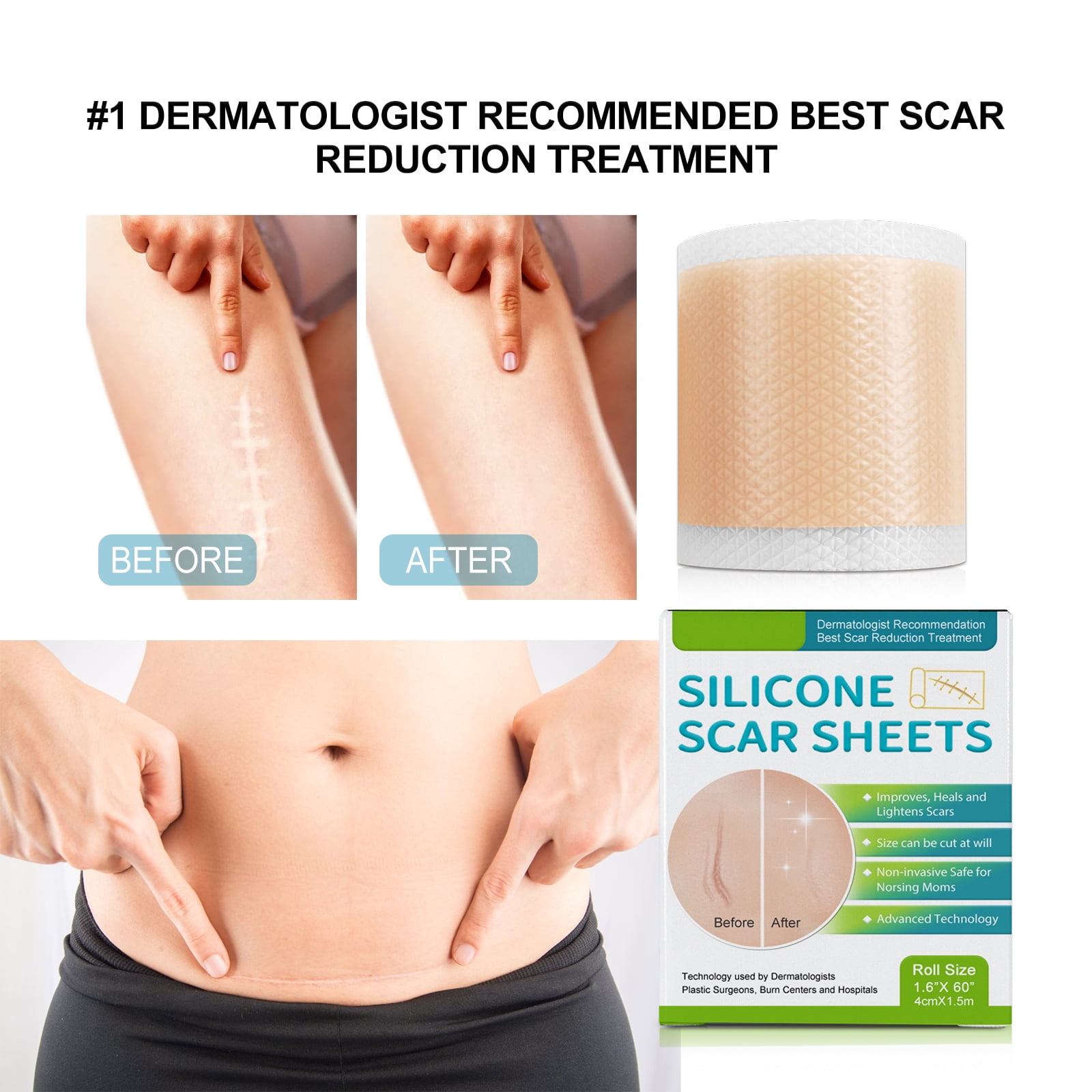 Alvantor Silicone Scar Sheets - Medical Grade Scar Tape Roll for C-Section, Surgery, Burn, Acne Scars Treatment, 1.6"*60"