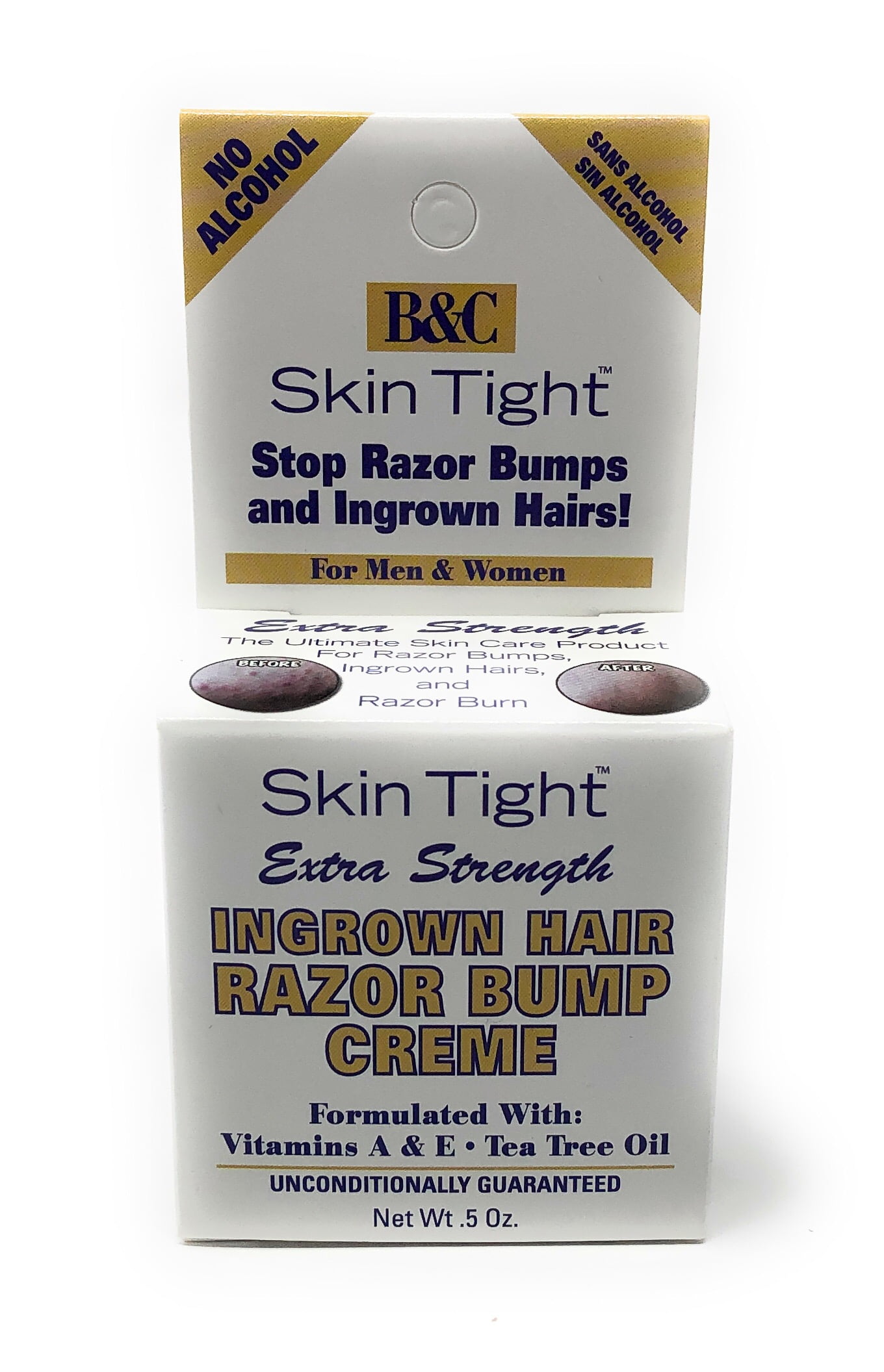 17 Best Ingrown Hair Treatments Tested  Reviewed for 2023