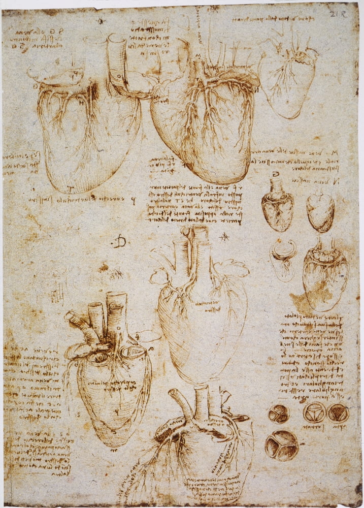 C1512 ошибка лексус