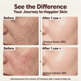 thumbnail image 5 of Morovan Face Moisturizer Tallow Cream Hyaluronic Acid Day Night Skin Care Sensitive Skin 2 fl oz, 5 of 9