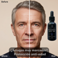 thumbnail image 2 of Suero Facial para Hombre - Ácido Hialurónico 10% Puro - Hidratación Profunda y Antiedad - Líneas de Expresión - Con Colágeno y Vitamina E - Textura Ligera No Grasa - 30 ml (Hialuronico MEN), 2 of 10