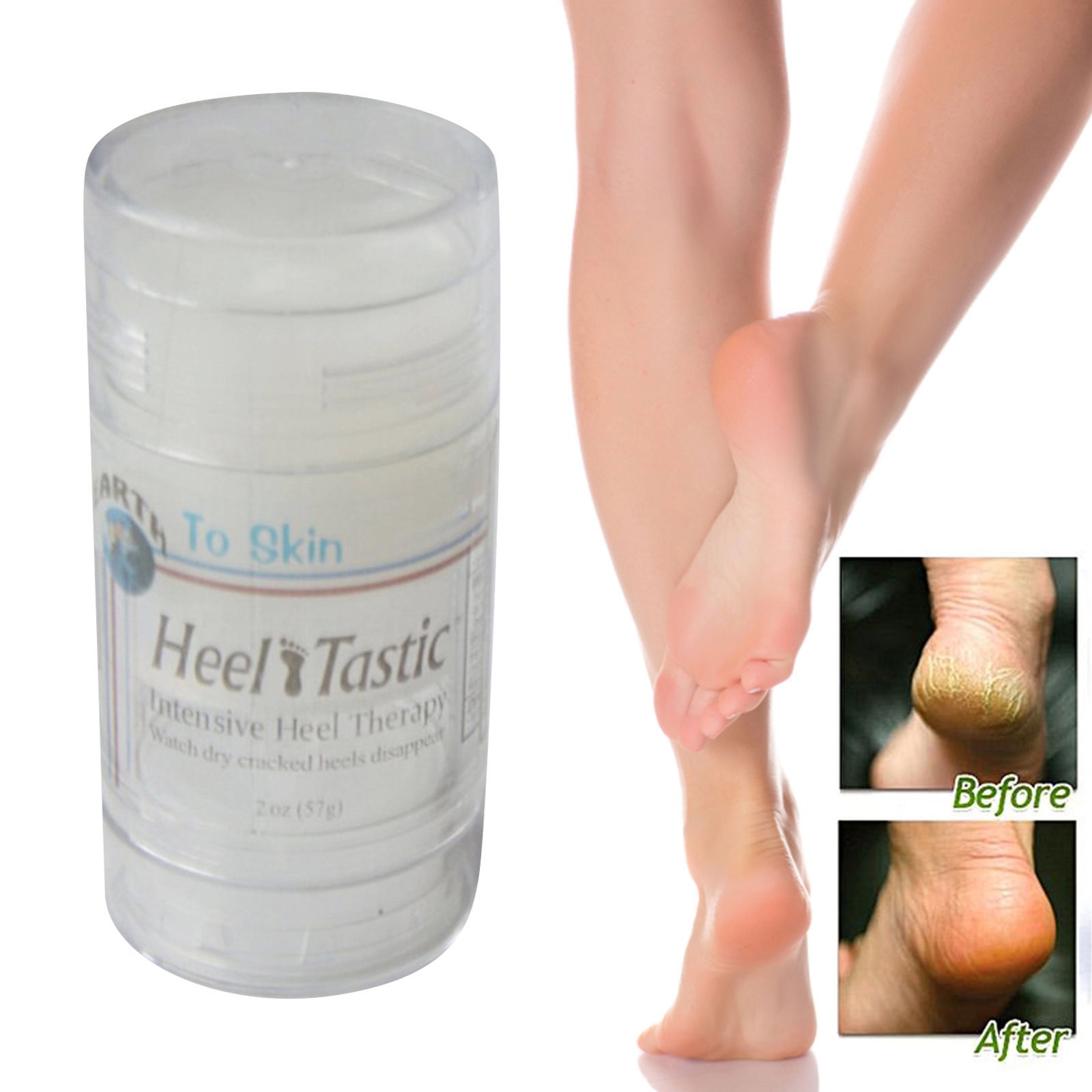 Cracked Heel Cream - Footness Cosmetics