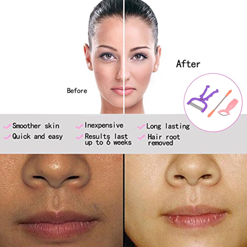 facial hair removal for women
