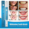 thumbnail image 5 of Gel limpiador de dientes con bolígrafo de 5 ml para eliminar manchas y sonreír al instante, 5 of 5