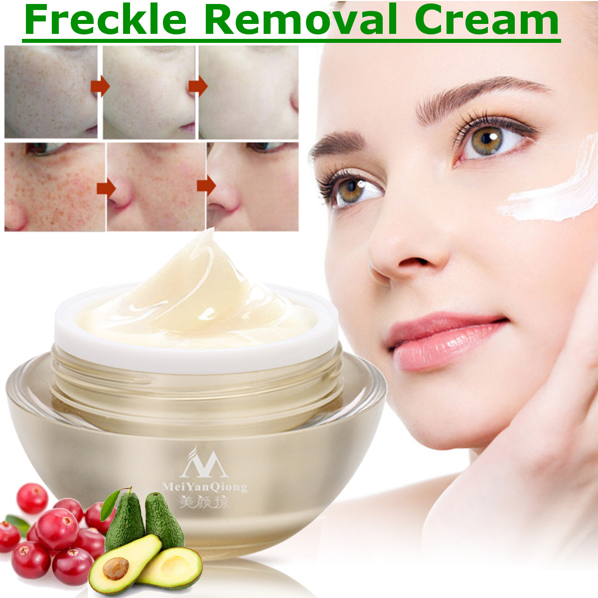 medicated freckle cream