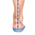thumbnail image 3 of Healthy Heel Gel Cups Pair, Mens, 3 of 6
