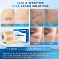 thumbnail image 3 of Silicone Scar Sheets, Silicone Scar Tape(1.6” x 60” Roll 1.5M), Silicone Scar Sheets for Surgical Scars, Keloid Bump Removal, Stretch Marks Removal, C-Section, Burn et, 3 of 7