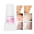 thumbnail image 3 of Old New Scars Cream, Multifunctional Skin Repairing Scars Caring Gel  For Burn Scar For Surgical Scar For Home For  Scars, 3 of 8