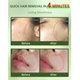 thumbnail image 3 of Crema de depilación facial Zeponyx Painless para mujeres, 3 of 7