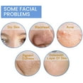 thumbnail image 4 of HOYGI Espuma Limpiadora de Arándanos Espuma Limpiadora Facial de Arándanos Espuma Limpiadora Facial Espuma Limpiadora Facial 100ml loción limpiadora, 4 of 9