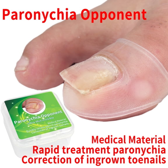 Mavis Laven Ingrown Toenail Corrector,Ingrown Toenail Correction Tool,2pcs Silicone Ingrown Toenail Correcting Tool  Paronychia Treatment Corrector