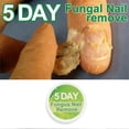 thumbnail image 5 of Nail Fungus Remover Nail Removal Cream Nail Repair Cream, 5 of 5