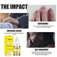 thumbnail image 3 of 3x 10ml Rapid Relief Oil, Onychomycosis Nail Treatment, Toenail Treatment Oil, 3 of 5
