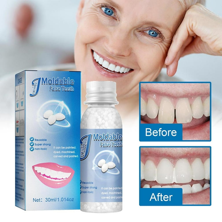 Temporary Tooth Repair Moldable Tooth Solid Gel Adhesive Fake