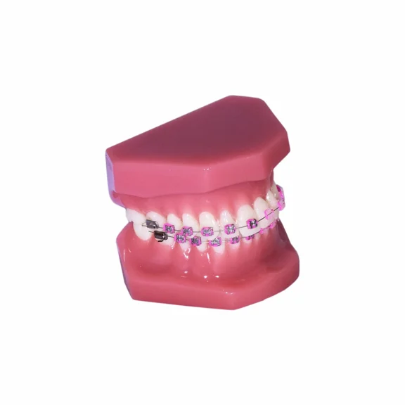 Redland B6-02 Dental Demonstration Model – Orthodontic Teeth Educational Tool