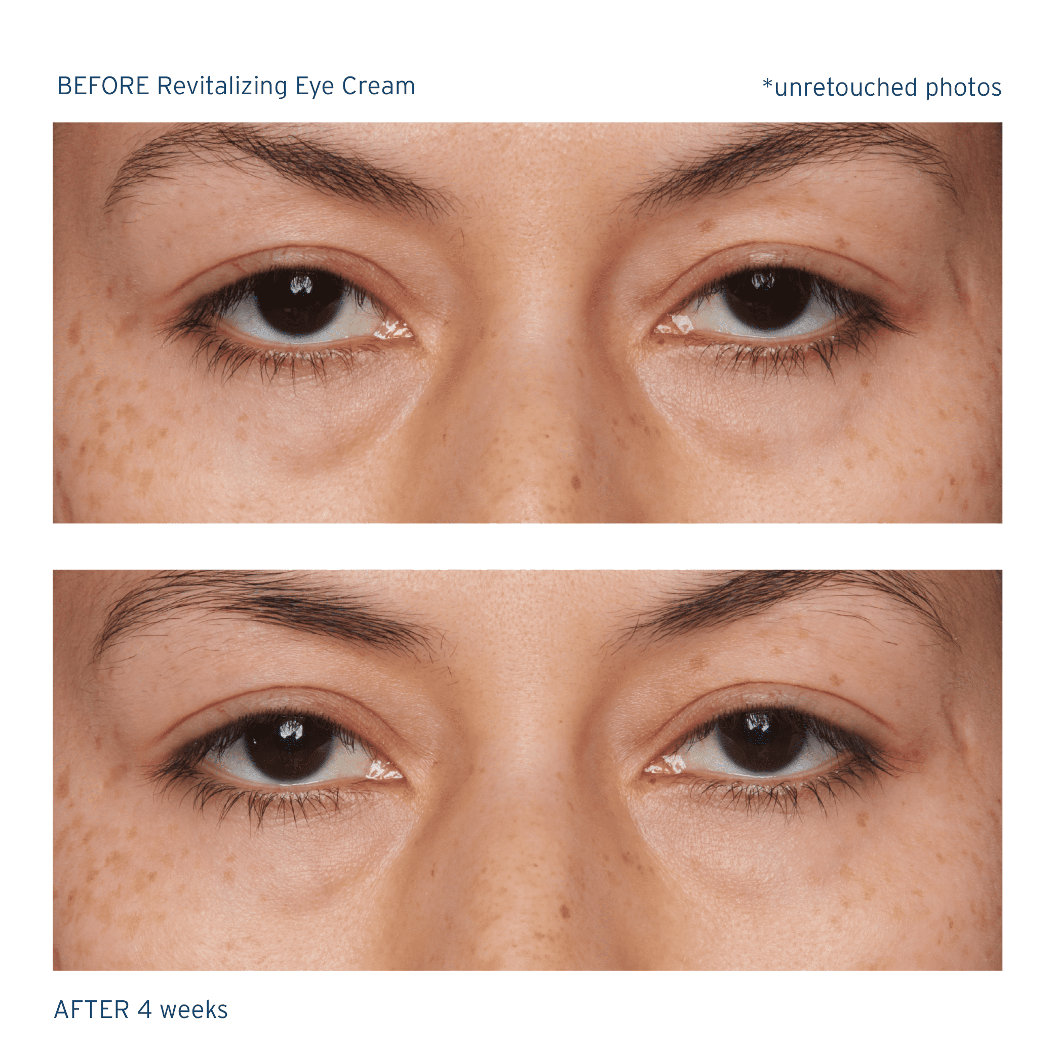 Santo Remedio, Piel Eterna, Revitalizing Eye Cream, Illuminating Eye Cream, Helps Reduce Dark Circles, Contains Marina Algae, Caffeine, Aloe, Hyaluronic Acid, Vitamin E, For All Skin Types, 1 Fl. Oz.