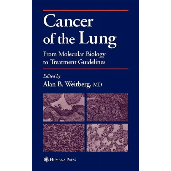 Current Clinical Oncology Cancer of the Lung: From Molecular Biology to Treatment Guidelines, (Hardcover)