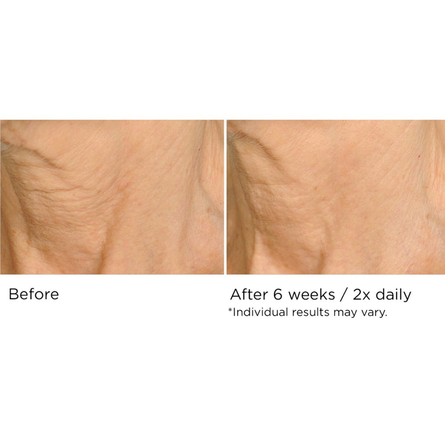Deco-Lift Neck  Decollete Firming  Lifting Complex 1.7 oz