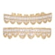 thumbnail image 2 of Decoración de dientes, juego de soportes para dientes chapados, juego de soportes para dientes, soporte para dientes dorados, funcionalidad de alta precisión, 2 of 8