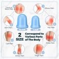 thumbnail image 3 of Set de terapia con ventosas TrelaCo, silicona anticelulítica, 12 unidades, 3 of 6