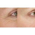thumbnail image 4 of Sta-Tight de Biologic Solutions, alivia las líneas de la edad Patas de gallo alrededor de los ojos Boca Frente Antienvejecimiento 0.5 oz. Biologic Solutions 413028, 4 of 4