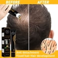 thumbnail image 4 of Suero para el crecimiento del cabello para hombres y mujeres - Solución natural para el crecimiento del cabello, 4 of 8