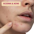 thumbnail image 4 of Toallitas con ácido hipocloroso BASE LABORATORIES para rostro y piel 75, 4 of 9
