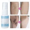 thumbnail image 1 of Hair Growth Inhibitor Hair Growth Inhibitor Spray Non Irritating Hair Inhibition Liquid For Legs Body Armpit 20ml ANGGREK Leg Hair Inhibitor, 1 of 8