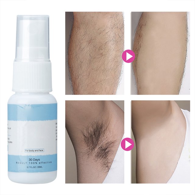 Hair Growth Inhibitor Hair Growth Inhibitor Spray Non Irritating Hair Inhibition Liquid For Legs Body Armpit 20ml ANGGREK Leg Hair Inhibitor