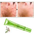 thumbnail image 4 of Clearance, Acne Remove Acne Oil Control Oil Shrink Pores Whitening and Moisturizi, 4 of 4