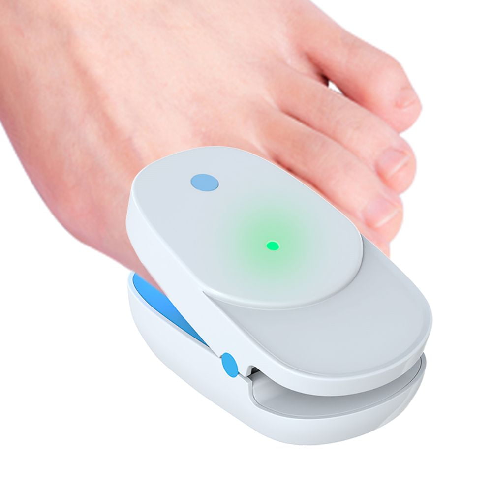 Amazon.com: Ncure Nail Fungus Onychomycosis Fungal Remover The Most  Efficient Rechargeable Laser Device Treatment for Home Use : Health &  Household