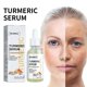 thumbnail image 1 of OUHOE Turmeric Facial Repair Essence, skin repair, anti-wrinkle, lightening of fine lines and dark spots, hydrating and mo, 1 of 4
