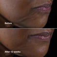 thumbnail image 3 of Crema Clinique Smart Clinical Repair para rostro y cuello, 3 of 7