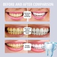 thumbnail image 4 of Jaysuing Teeth Essence Cleans Teeth Stains, Brightens Teeth, Freshens Breath, Cares Gums and Teeth Essence, 4 of 5