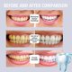 thumbnail image 4 of Jaysuing Teeth Essence Cleans Teeth Stains, Brightens Teeth, Freshens Breath, Cares Gums and Teeth Essence | |, 4 of 5