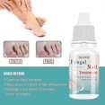 thumbnail image 4 of 1pc Fungal Nail Treatment Liquid Nail Repair Moisturizing Anti-bag Nursing Liquid, 4 of 5