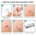 thumbnail image 4 of Pimple Popper Tool Kit, Remover Tool Ct Kit Pimple Ctor Facial Comeds, 4 of 5