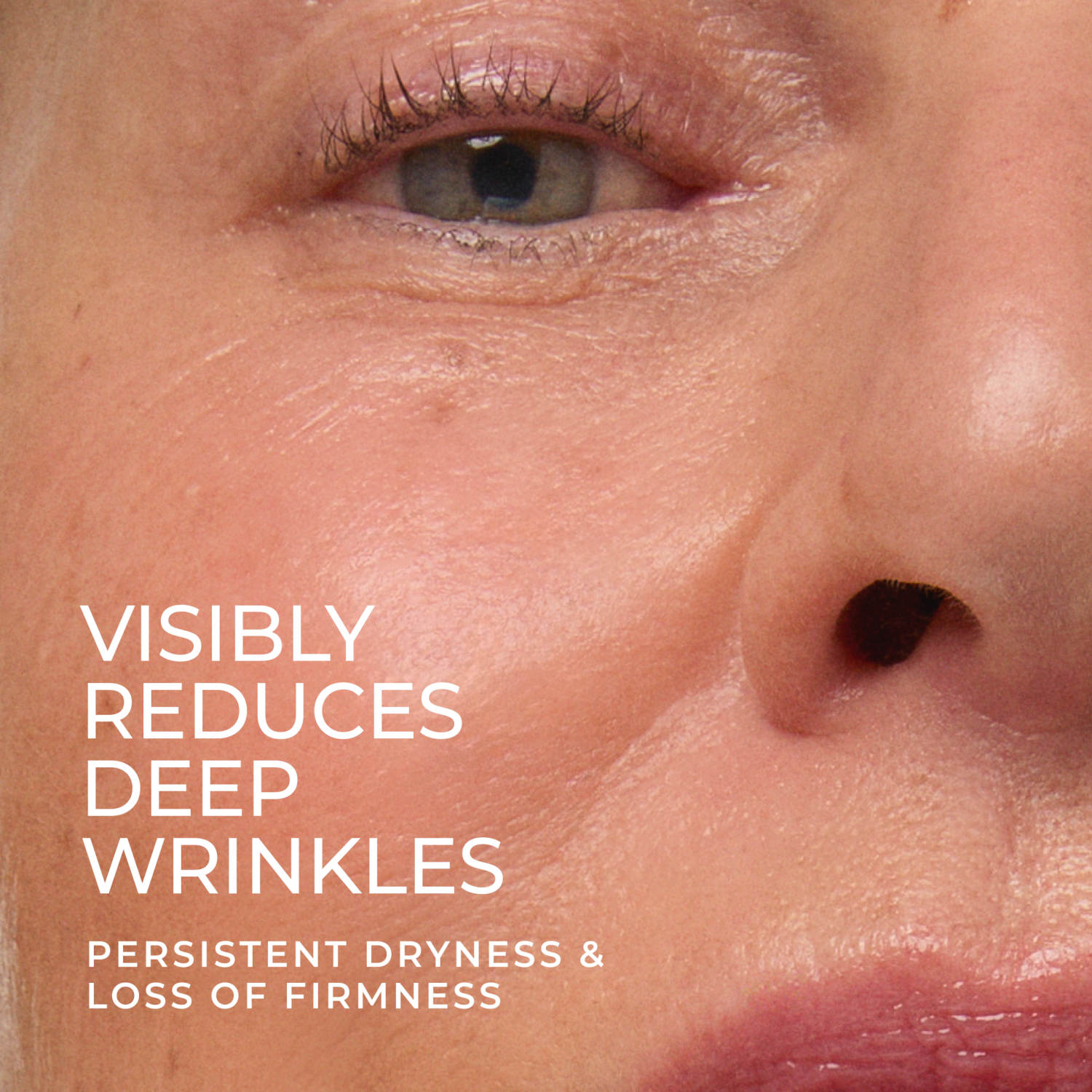 RoC Retinol Correction Deep Wrinkle Rich Cream photo 3