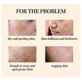 thumbnail image 2 of Rosacea-pomada roja para la nariz, crema para eliminar espinillas y acné, cuidado de la piel, hierbas, antiacné y ácaros, tratamiento para reducir los poros"one" Fivean LED, 2 of 2
