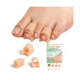 thumbnail image 1 of wonima44 Hammer Toe Straightener Corrector - 12 Pack（3 Size） Silicone Toe Sleeves Toe Spacers for Foot Alignment, Comfortable Foot Care for Overlapping Toes, 1 of 1