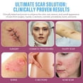 thumbnail image 5 of Silicone Scar Gel for New & Old Scars, Deeply Hydrates and Smooths Scar Tissue, Medical-Grade Ingredients for All Scar Types, 1 oz (2 pack), 5 of 10
